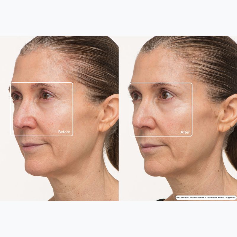 Маска LED для обличчя Therabody TheraFace LED Mask 10