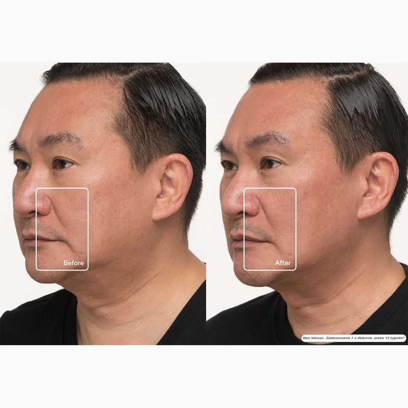 Маска LED для обличчя Therabody TheraFace LED Mask 12