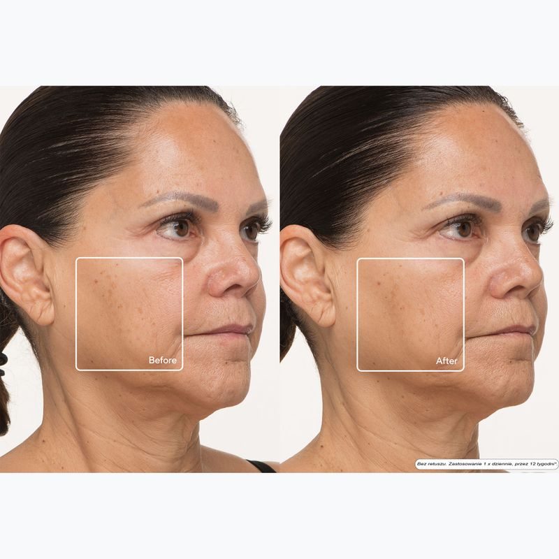 Маска LED для обличчя Therabody TheraFace LED Mask 13